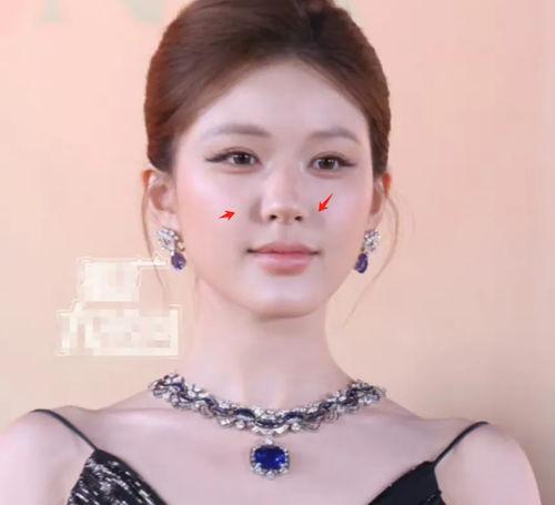 赵露思否认整容