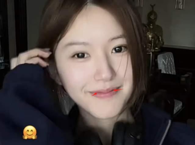 赵露思否认整容